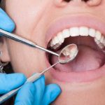 woman mouth open dentist looking inside